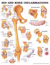 Informative chart is useful for teaching patients, students