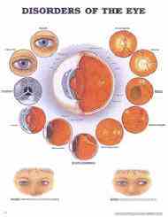 Study eye disorders